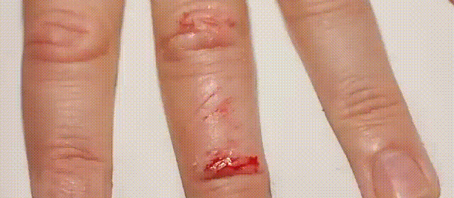 Recovery